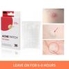 Cross-border Hydrogel Acne Pimple Patch