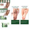 Hoygi Tea Tree Oil Foot Cream For Moisturizing And Healing Dry Cracked Heels 50ml