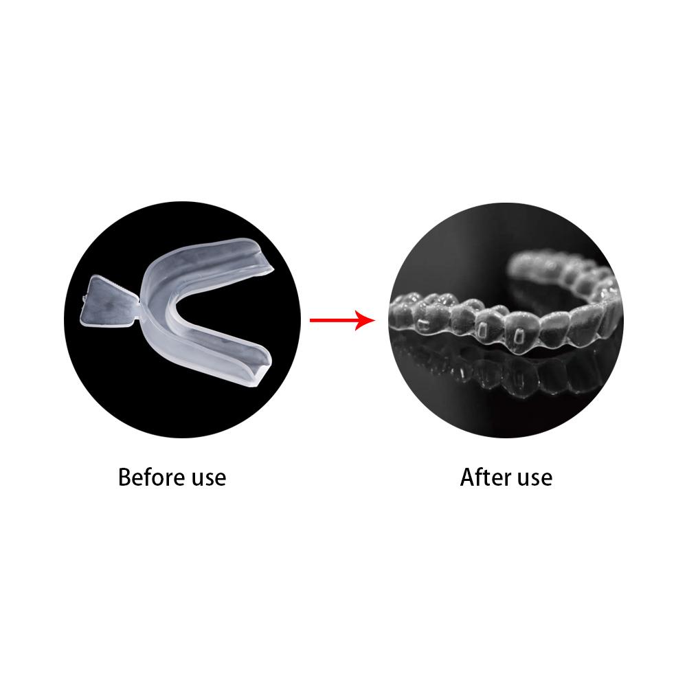 Schutz Stop Zähneknirschen Bruxismus Zahnaufhellung Zahnschutz Mundschutz Mundschale Boxen Schutz