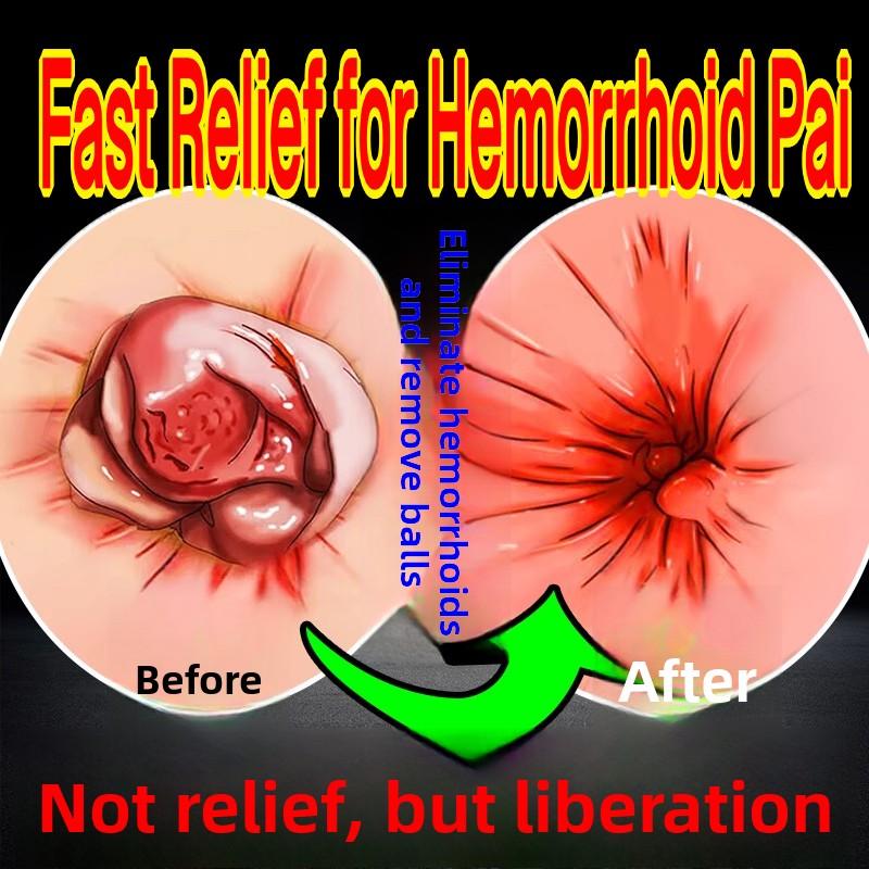 Thai Hemorrhoid Soothing Ointment 55g - Fast Relief for External Discomfort, Upgraded Version