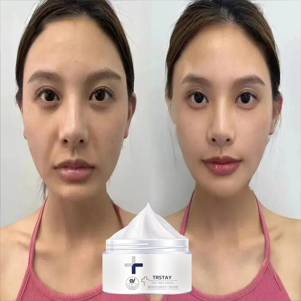 Moisturizing Cream Is Gentle and Non-irritating, Firms the Skin, Brightens the Complexion, Reduces Blemishes, Hydrates and Nourishes the Skin