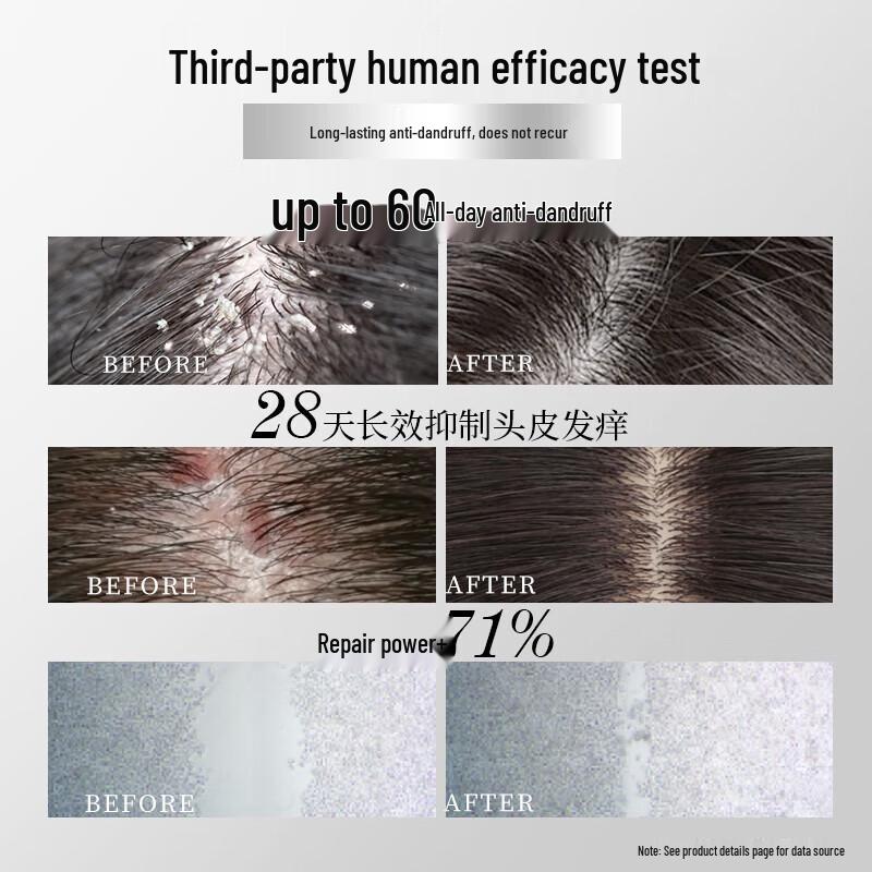 ZIYUAN Blue Aurora Anti-Dandruff Oil Control Shampoo 215g