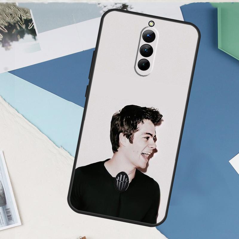 

Teen Wolf Dylan O Brien Case For ZTE Nubia Red Magic 11 10 9 8 8S 9S 10S Pro Plus 6 7 6S 7S Pro 5G 6R 10 Air Cover Red Magic 11 Pro