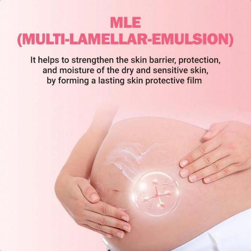 Atopalm Maternity Care Stretch Mark Cream 150ml , Canola Oil Postpartum Skin Care| Pregnancy Red Lines Relief | Skin Swelling Elasticity Improvement