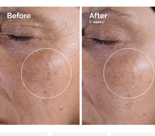 The Ordinary Glycolic Acid 7% Toner – Exfoliating & Brightening Solution 240ml