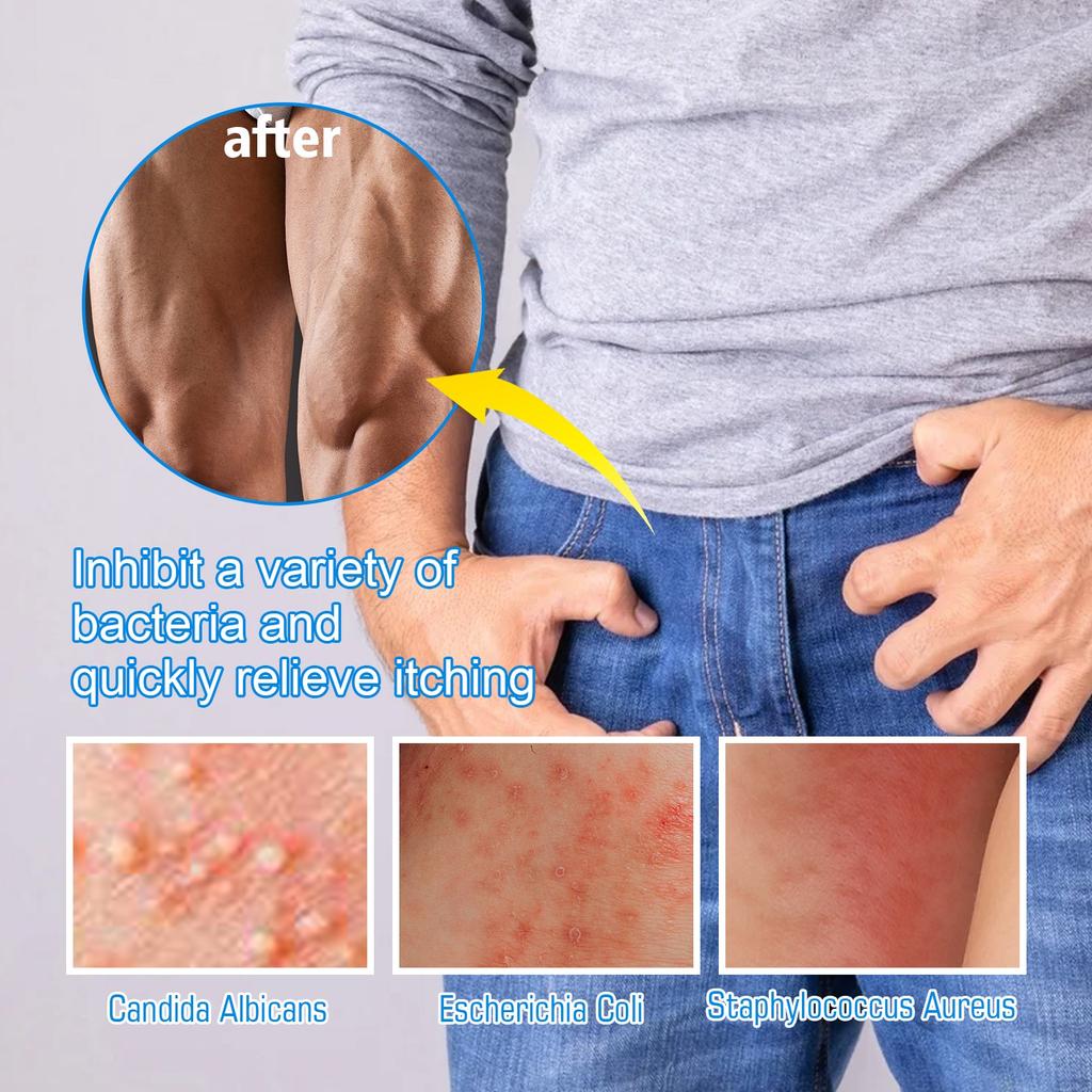 Pasta per la prostata Uomo Erbe prostatiche Unguento Deficienza renale Controllo della vescica Assistenza sanitaria maschile