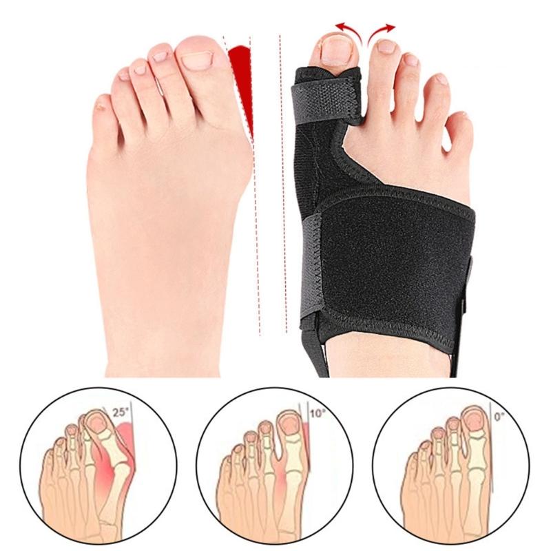 Bunions Corrector for Women Men Orthopedic Bunions Correction Big Toe Separators,Adjustable Bunions Splint Pads Gifts