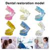 Dental Implant Model Teaching Aid for Dentist Student School Removable Teeth
