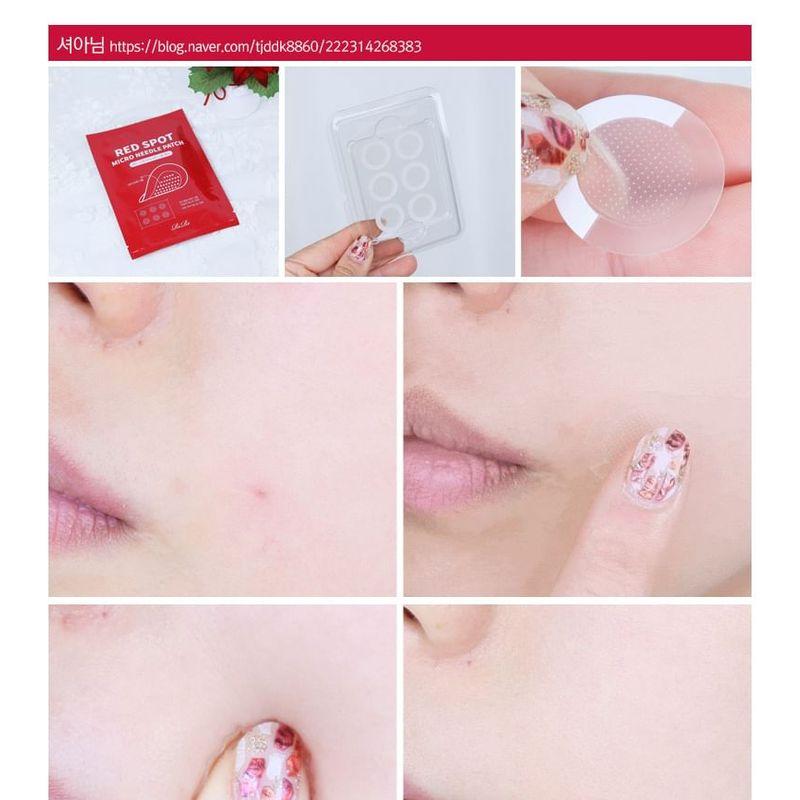RiRe - Red Spot Micro Needle Patch