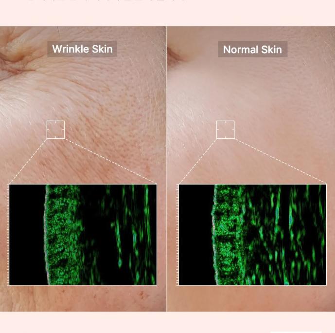 Medicube Collagen Glow Booster Serum 150ml – Intensive Firming & Radiance Care