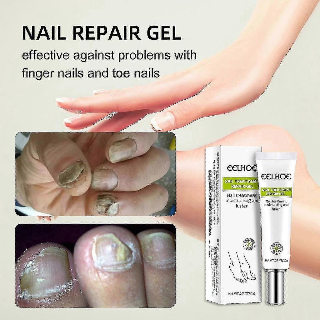 Eelhoe Nail Gel 1pc