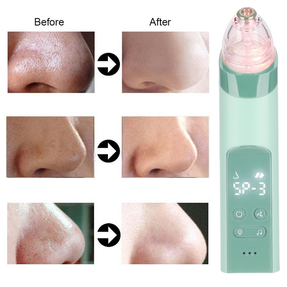 Aspirator nazal electric multifuncțional cu aspirație, mașină de curățare a punctelor negre(Verde )