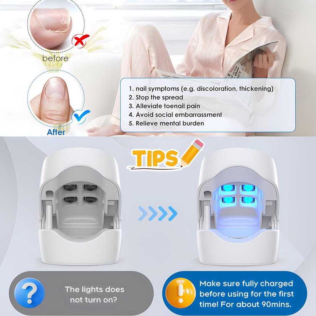 Nail Fungus Treatment Tools Fungal Nail Treatment Anti-Equipment Effectively Remove Fungal Toenail Nail Fungal Infection
