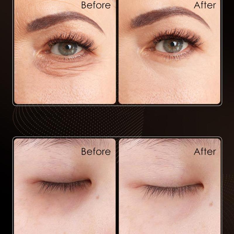 MERCILEN Anti-Wrinkle Firming Eye Cream - Morning And Evening Electric Facial Cream For Toning And Moisturizing