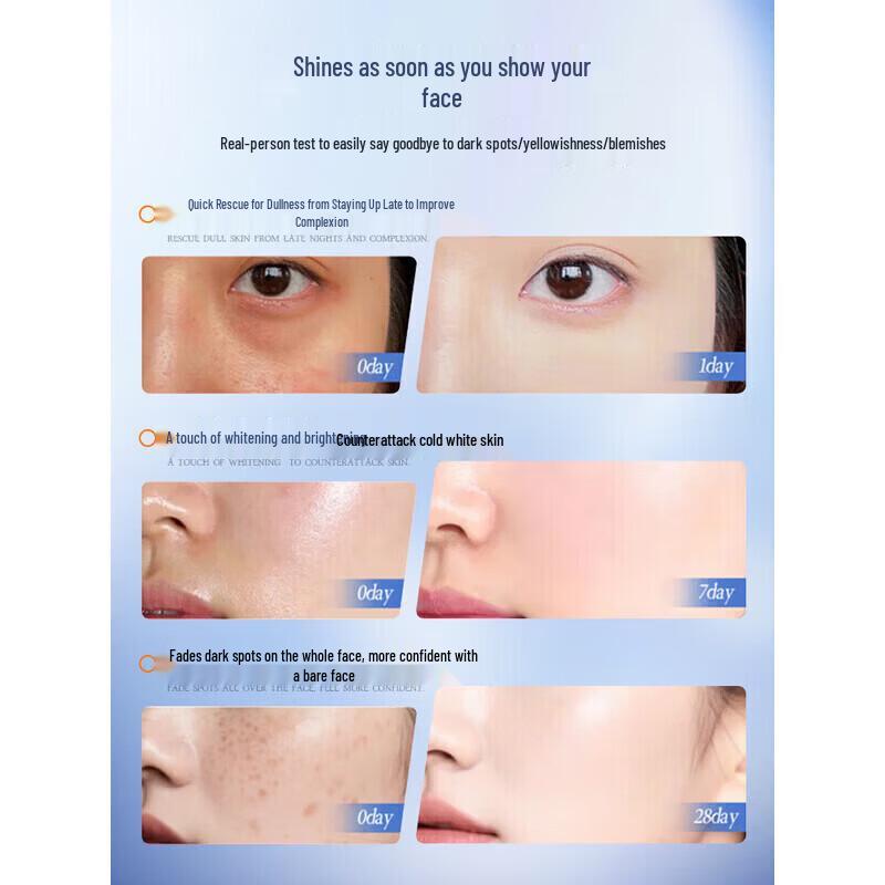 RUYI Whitening Spot Removal Face Cream