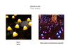 Solar LED Mushroom String Lights with Remote for Outdoors