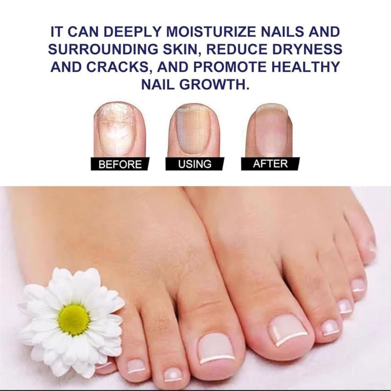 Posílení slabých nehtů 10 ml Revitalizační tekutina na kůžičku s kyselinou hyaluronovou + keratinem + vápníkem Hydratační péče o nehty