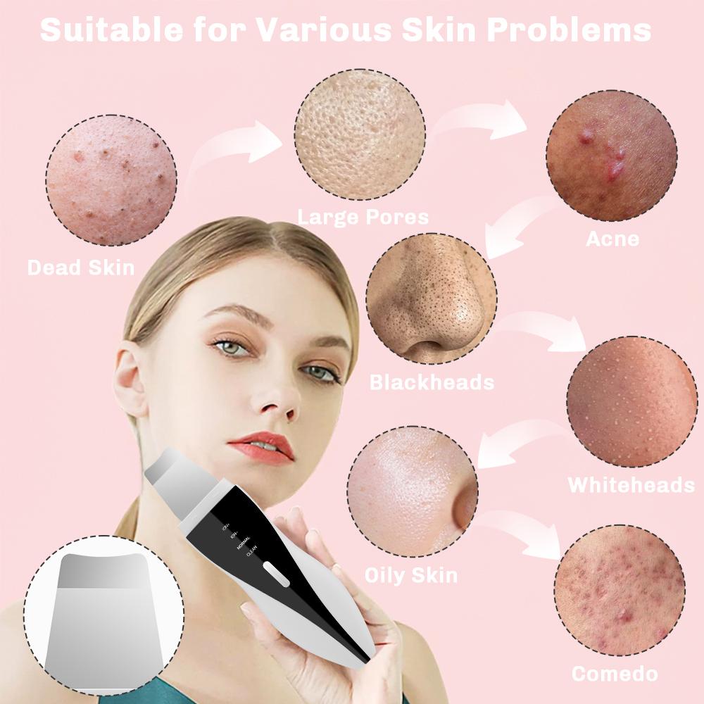 Ultrasonic Skin Scrubber Face Spatula Facial Skin Exfoliator Scraper and Blackhead Remover Pore Cleaner Facial Deep Cleansing