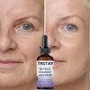 Whitening Freckle Cream Effektiv Fjern Melasma Dark Spots Cream Fade Fuktighet Gjøre Glatt Skjønnhet Ansikt Hudpleie