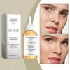 Ouhoe 7% Glycolic Acid Moisturizing Toner, Exfoliating Essence for Closed Comedones, Improves Skin Texture, Brightens & Smooths Skin