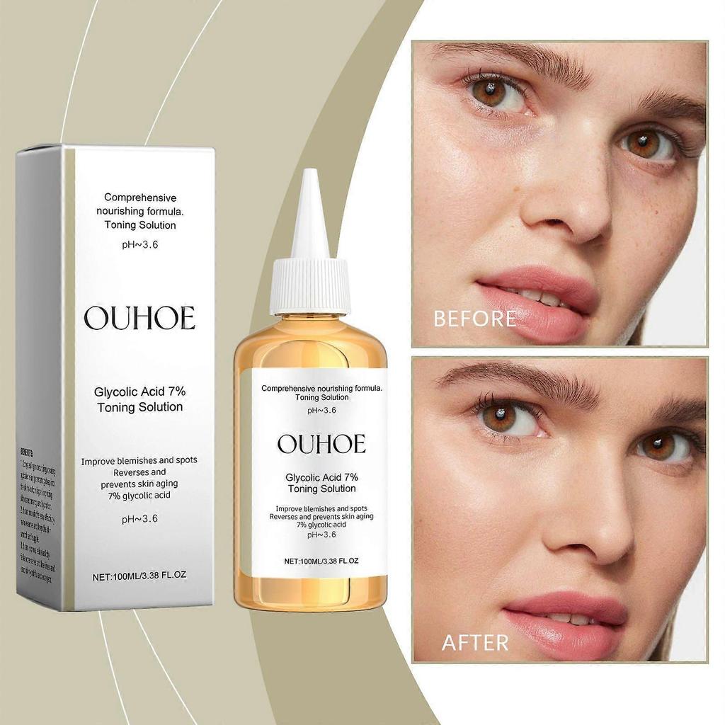 Ouhoe 7% Glycolic Acid Moisturizing Toner, Exfoliating Essence for Closed Comedones, Improves Skin Texture, Brightens & Smooths Skin