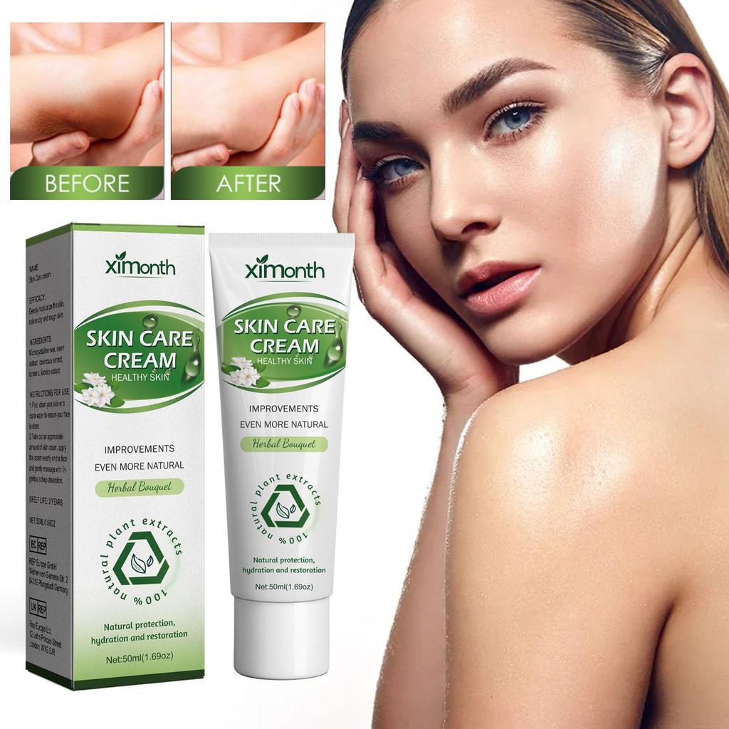 Kräuternährende Creme zur Aufhellung dunkler Haut an Gelenken und am Körper, feuchtigkeitsspendend und aufhellend, Körper- und Gelenkhautpflegecreme