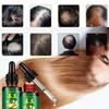 7denní zázvorové zárodečné sérum Essence Oil Loss Ošetření pro obnovu růstu vlasů 30 ml Rychlé vlasy Přírodní péče o vlasy proti vypadávání vlasů