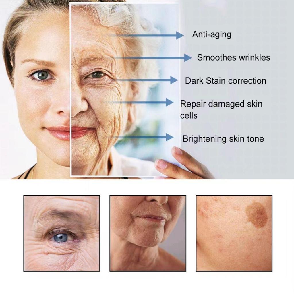 Tca Aid Skin Peel Trichloroacetic Acid 20% Skin Peel Pore Minimizing Wrinkles Spots Skin Care Face Serum