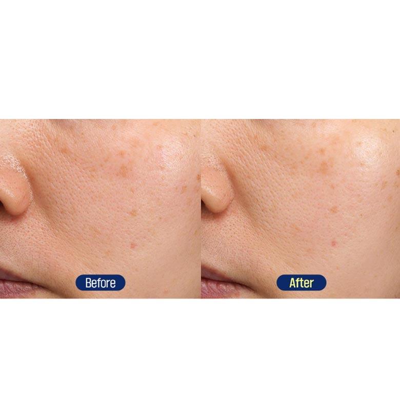 FATION Mela Zero Dark Spot Toning Cream 50ml