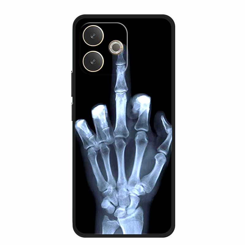 For Oppo A5 Pro 5G 4G Case CPH2695 CPH2711 Soft TPU Silicone Cover for A5 Pro Soft Case Protective Phone Case Oppo A5 A 5Pro 4G