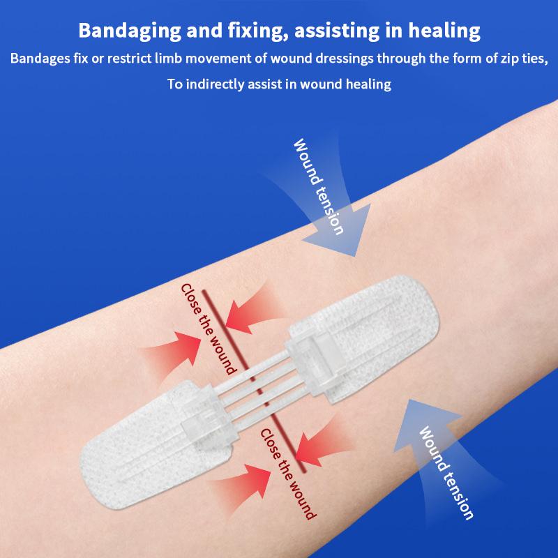 Plaster do zamykania ran na zamek błyskawiczny Plaster hemostatyczny Szybkie szwy na rany Bandaże przenośne na zewnątrz do pielęgnacji ran