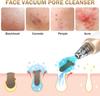 Electric Remover Blackhead Pore Vacuum Kit Blackhead Extractor Implements with 3 Suction Level 5 Probes Suitable for Women and Men