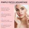 Ouhoe Acne Healing Patches For Gentle Skin Care And Effective Pimple Coverage 240 Patches