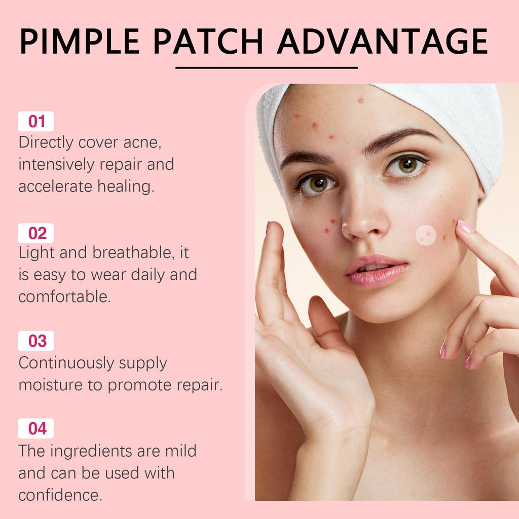 Ouhoe Acne Healing Patches For Gentle Skin Care And Effective Pimple Coverage 240 Patches