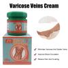 ZB Varicose Veins Relief CreamVasculitis Phlebitis Spider Pain ReliefOintment Medical Plaster Body Care 20g
