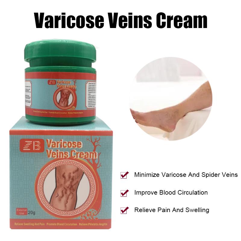 ZB Varicose Veins Relief CreamVasculitis Phlebitis Spider Pain ReliefOintment Medical Plaster Body Care 20g