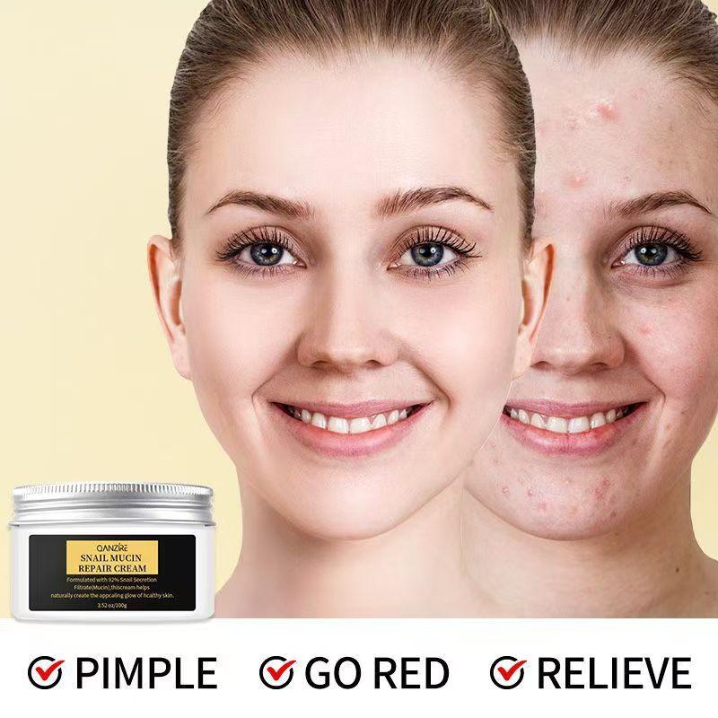 Schneckenschleim Reparaturcreme Anti-Aging Straffend Feuchtigkeitsspendend 100g