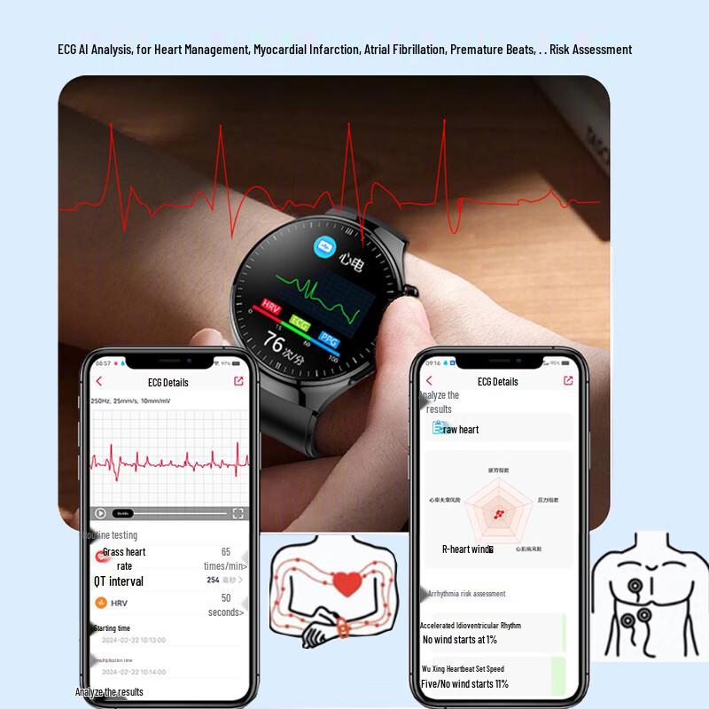 Smart Health Monitoring Watch with ECG & Blood Pressure (CN version)
