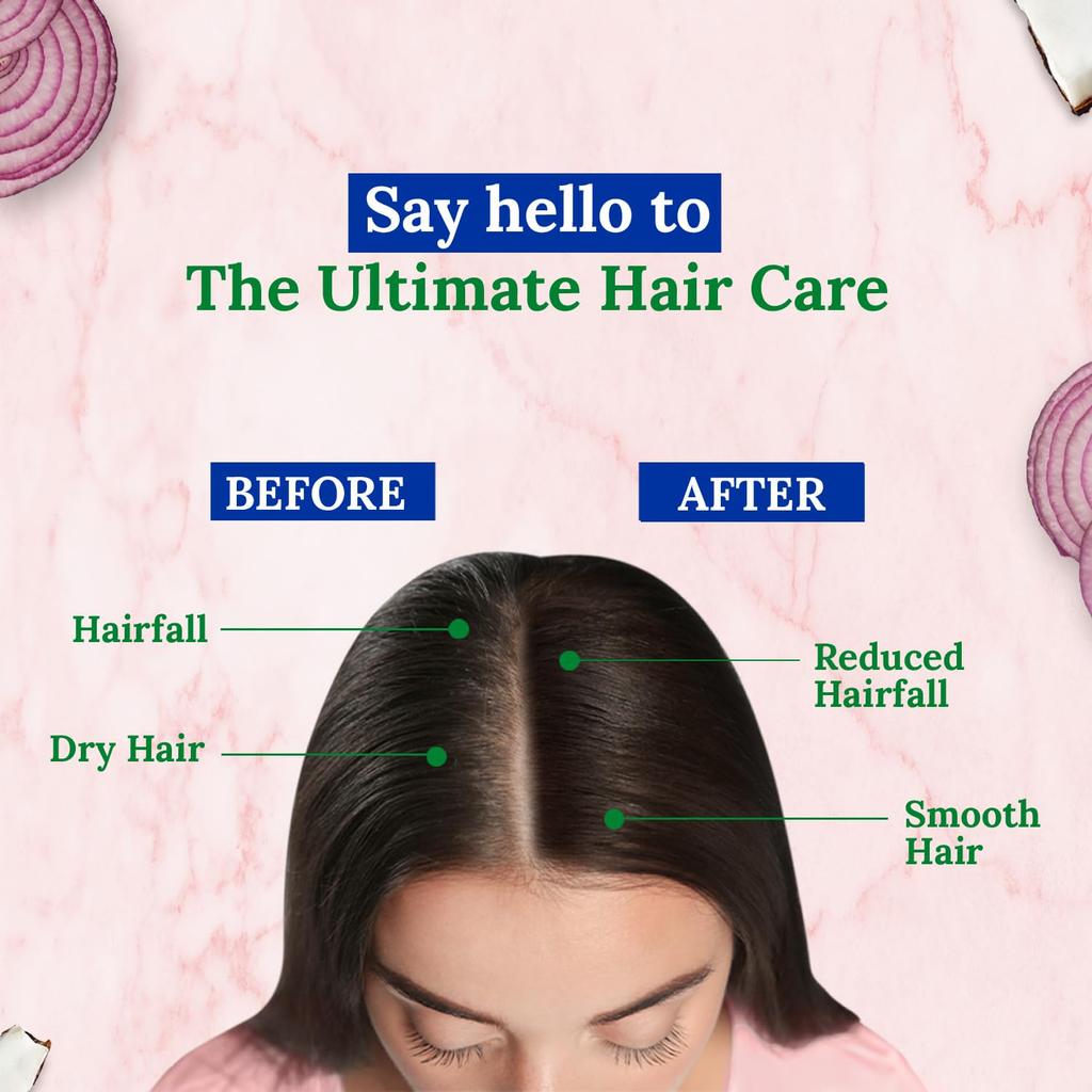 PARACHUTE Advansed Onion Hair Oil For Hair Growth & Hair Fall Control With Coconut & Vitamin E – 200ml Nourishing Scalp Care