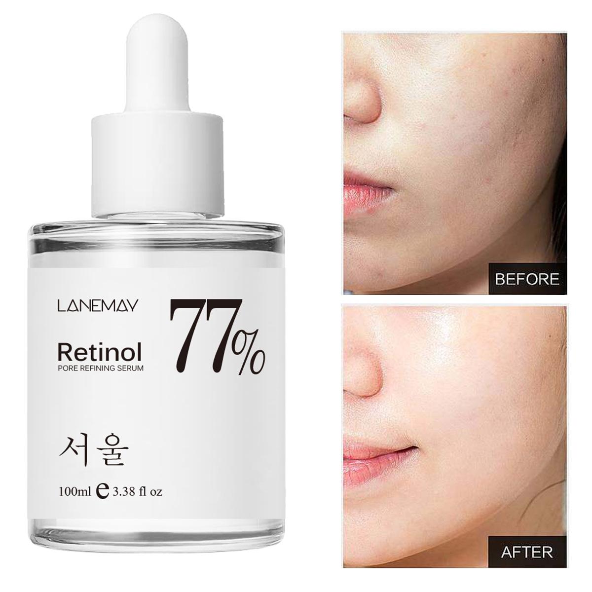 

100 мл 92% Успокаивающая эссенция для лица с муцином улитки Мультиуход Увлажняющая и увлажняющая сыворотка для лица 100ml