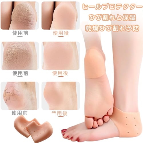 Heel Protectors, Heel Supports, Set of 4 (2 Pairs), Insoles, Heel Covers, Heel Moisturizing, Prevents Blisters, Shock Absorbing, Reduces Stress, with