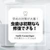 Smile Cosmetic Whitening with 1450ppm Fluoride for Cavity Teeth and Bad Breath Paste, 85ml, Prevention, Whitening, [Quasi-drug]