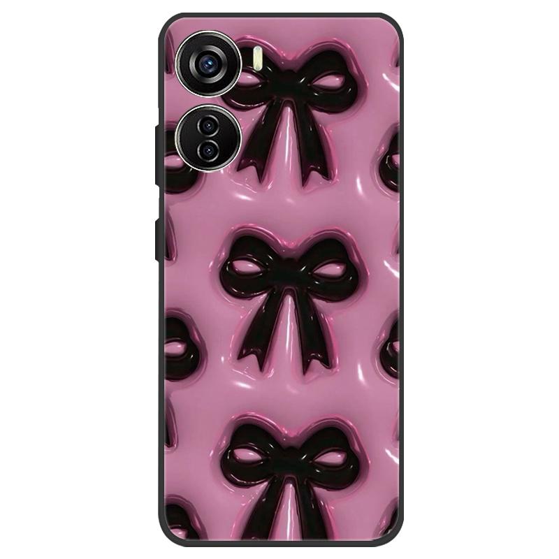 For ZTE Nubia Neo 5G Case Silicone Luxury Space Soft Bumper for ZTE Nubia Neo 5G Phone Cover TPU Funda Nubia Neo Fashion Bag