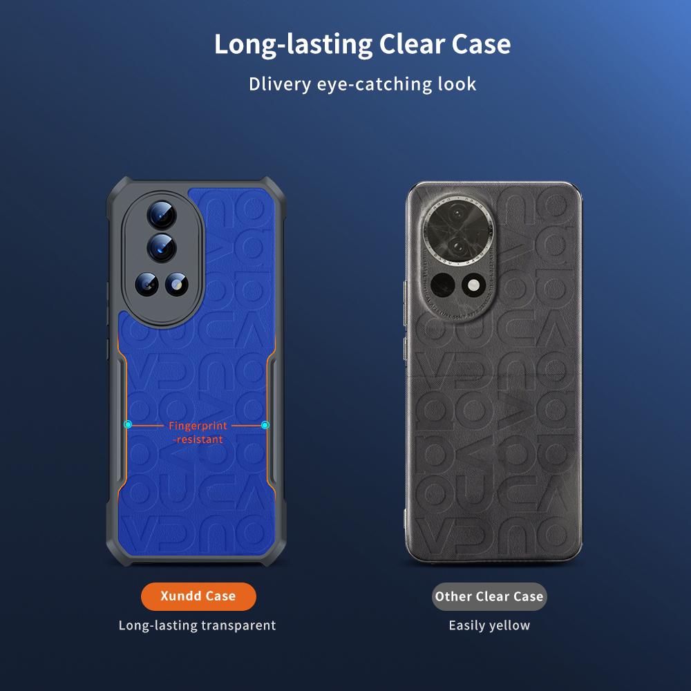 XUNDD For Huawei nova 12 Pro 5G/nova 12 Ultra 5G Case Acrylic+TPU Protective Back Cover