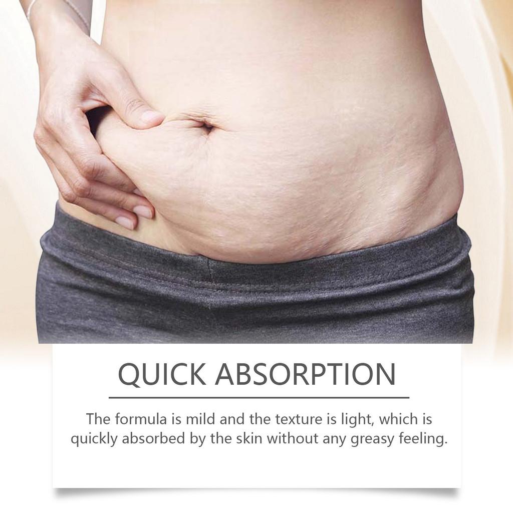 Ouhoe Pregnancy Care Rose Cream For Moisturizing And Firming Skin Reducing Stretch Marks