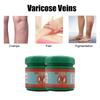 ZB Varicose Veins Relief CreamVasculitis Phlebitis Spider Pain ReliefOintment Medical Plaster Body Care 20g