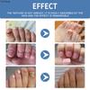Nail Care Gel Hand Foot Onychomycosis Soft Nail Thickening Nail Luminescent Nail Repair Gel