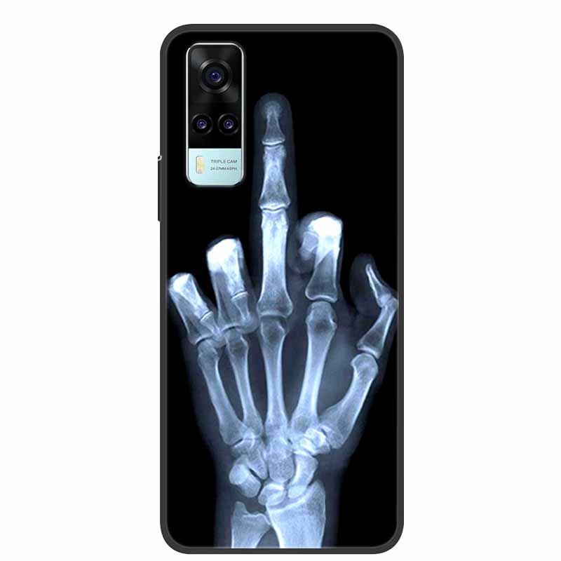 For vivo Y31 2021 Case Shockproof Soft silicone TPU Back Cover For Vivo Y53S 4G Y31 2021 Y 31 Case V2036 Phone Case Cute Cartoon