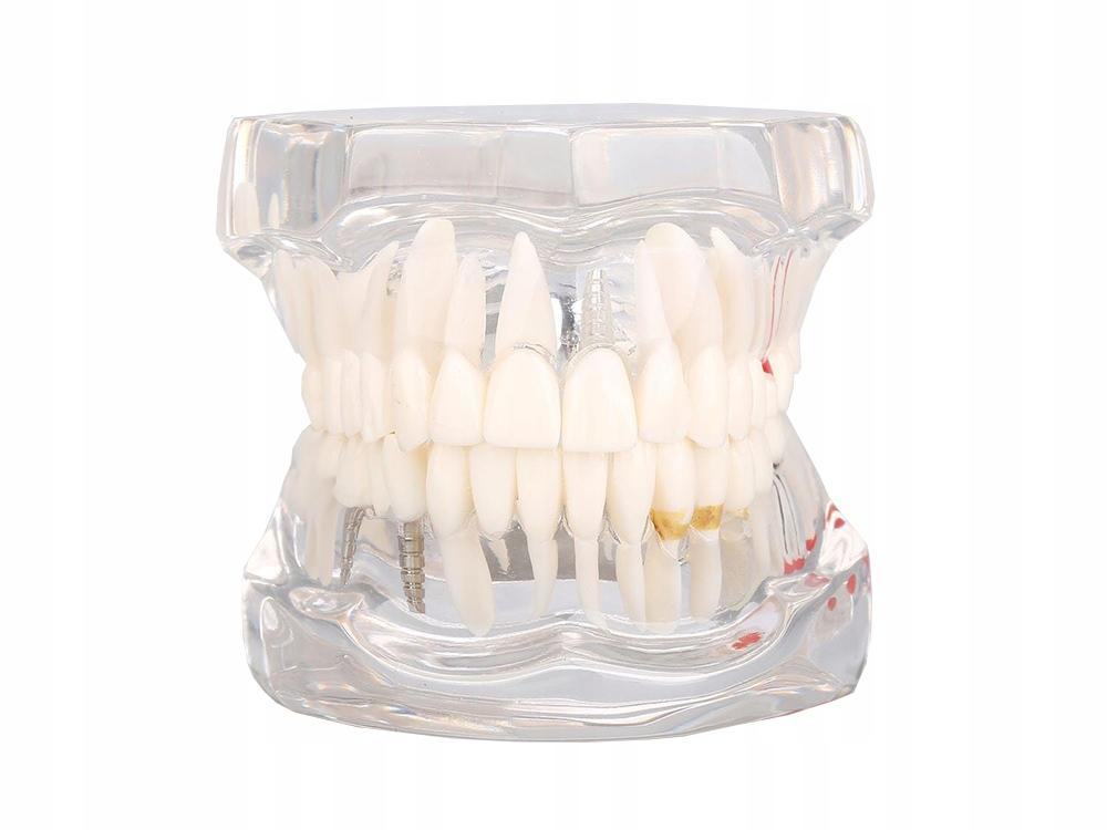 Dental Model 2 White (100) Gab_B