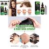 Jaysuing Castor Oil Hair Growth Serum Nourishing Moisturizing Anti Hair Loss 60ml